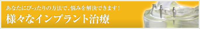 様々なインプラント治療　あなたにぴったりの方法で、悩みを解決できます！