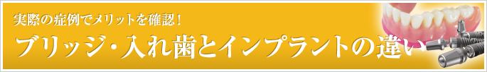 ブリッジ・入れ歯とインプラントの違い。実際の症例でメリットを確認！実際の症例でメリットを確認！